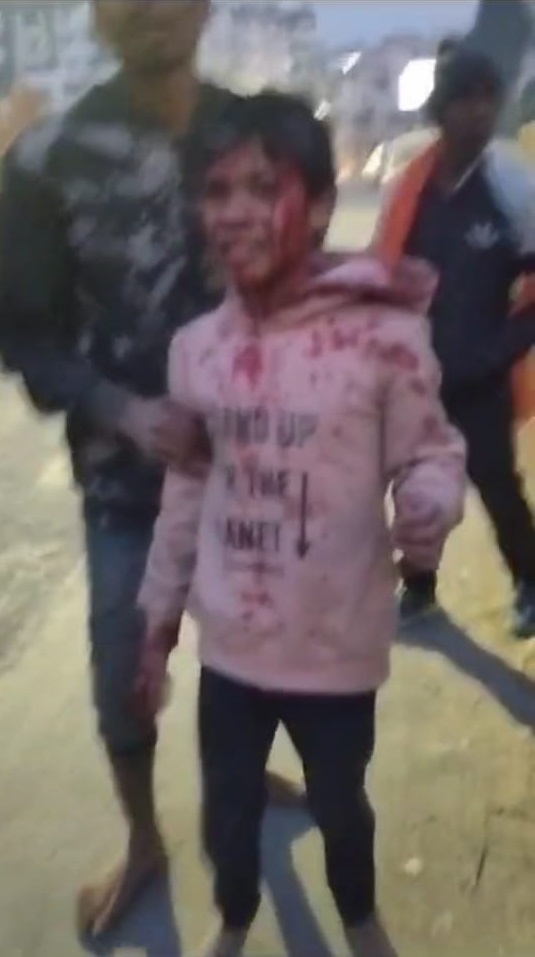 tiger attack on child in jakhan area of dehradun